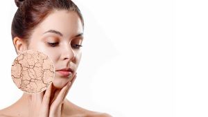 A woman with dry skin on her face